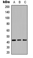 Western blot analysis of Cytochrome P450 27C1 expression in HEK293T (A); NIH3T3 (B); PC12 (C) whole cell lysates.