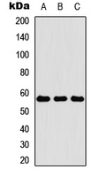 Western blot analysis of Cytokeratin 4 expression in HEK293T (A); Raw264.7 (B); PC12 (C) whole cell lysates.