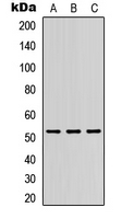 Western blot analysis of DMRTA1 expression in HEK293T (A); Raw264.7 (B); PC12 (C) whole cell lysates.