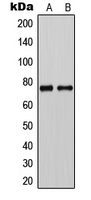 Western blot analysis of CLCNKA expression in HeLa (A); rat liver (B) whole cell lysates.