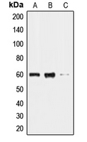 Western blot analysis of CLK2 expression in HL60 (A); HeLa (B); HepG2 (C) whole cell lysates.