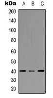 Western blot analysis of FPR3 expression in A549 (A); NS-1 (B); PC12 (C) whole cell lysates.