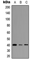 Western blot analysis of FPR3 expression in HEK293T (A); A549 (B); PC12 (C) whole cell lysates.