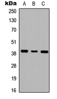 Western blot analysis of GALR1 expression in HEK293T (A); NS-1 (B); H9C2 (C) whole cell lysates.