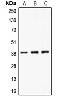 Western blot analysis of CLNS1A expression in A549 (A); K562 (B); Jurkat (C) whole cell lysates.
