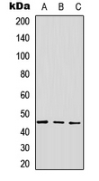 Western blot analysis of GPR143 expression in A549 (A); NS-1 (B); PC12 (C) whole cell lysates.