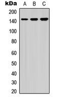 Western blot analysis of HCAP (pS1083) expression in A549 (A); NS-1 (B); PC12 (C) whole cell lysates.