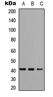 Western blot analysis of HLA-A/B/C expression in A549 (A); NS-1 (B); H9C2 (C) whole cell lysates.