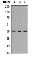 Western blot analysis of HOXC10 expression in HEK293T (A); NS-1 (B); H9C2 (C) whole cell lysates.