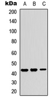 Western blot analysis of Kir4.2 expression in A549 (A); NS-1 (B); PC12 (C) whole cell lysates.