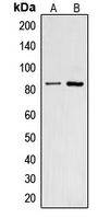 Western blot analysis of CNGA2 expression in HepG2 (A); A431 (B) whole cell lysates.