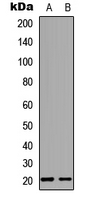 Western blot analysis of MED28 expression in Raw264.7 (A); PC12 (B) whole cell lysates.