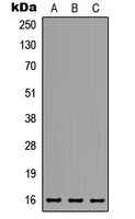 Western blot analysis of MED31 expression in HeLa (A); MCF7 (B); NS-1 (C) whole cell lysates.