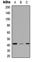 Western blot analysis of MESP2 expression in A549 (A); NS-1 (B); H9C2 (C) whole cell lysates.