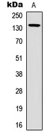 Western blot analysis of mGLUR1 expression in A549 (A) whole cell lysates.
