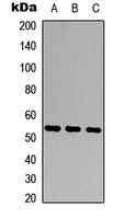 Western blot analysis of MMP20 expression in HEK293T (A); Raw264.7 (B); PC12 (C) whole cell lysates.