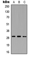Western blot analysis of MMP26 expression in HEK293T (A); Raw264.7 (B); H9C2 (C) whole cell lysates.