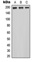 Western blot analysis of MRCK alpha expression in HEK293T (A); NS-1 (B); PC12 (C) whole cell lysates.