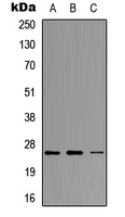 Western blot analysis of Neurogenin 1 expression in MCF7 (A); Raw264.7 (B); H9C2 (C) whole cell lysates.