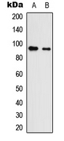 Western blot analysis of Neuroligin 3 expression in HEK293T (A); NS-1 (B) whole cell lysates.