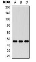 Western blot analysis of Nocturnin expression in HEK293T (A); PC12 (B); HeLa (C) whole cell lysates.
