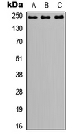 Western blot analysis of NOTCH3 expression in A549 (A); NS-1 (B); PC12 (C) whole cell lysates.