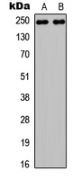 Western blot analysis of NOTCH3 expression in HEK293T (A); PC12 (B) whole cell lysates.