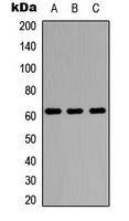 Western blot analysis of PDP1 expression in A549 (A); NS-1 (B); MCF7 (C) whole cell lysates.