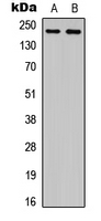 Western blot analysis of Plexin A4 expression in NS-1 (A); PC12 (B) whole cell lysates.