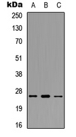 Western blot analysis of POLR3G expression in MCF7 (A); Raw264.7 (B); H9C2 (C) whole cell lysates.