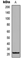 Western blot analysis of RhoXF1 expression in Jurkat (A) whole cell lysates.