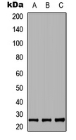 Western blot analysis of RND2 expression in HEK293T (A); NS-1 (B); PC12 (C) whole cell lysates.