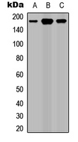 Western blot analysis of ROBO1 expression in HEK293T (A); Raw264.7 (B); PC12 (C) whole cell lysates.