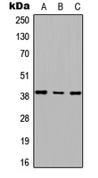 Western blot analysis of RTDR1 expression in HEK293T (A); Raw264.7 (B); PC12 (C) whole cell lysates.