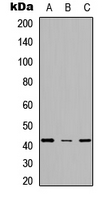 Western blot analysis of SCD expression in HeLa (A); NS-1 (B); PC12 (C) whole cell lysates.