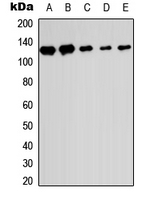 Western blot analysis of SENP6 expression in HEK293T (A); Raw264.7 (B); H9C2 (C); HeLa (D); HL60 (E) whole cell lysates.