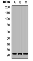 Western blot analysis of TGIF2LY expression in HEK293T (A); Raw264.7 (B); H9C2 (C) whole cell lysates.