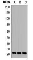 Western blot analysis of TGIF2LY expression in MCF7 (A); Jurkat (B); PC12 (C) whole cell lysates.