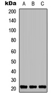 Western blot analysis of TNFAIP8L1 expression in MCF7 (A); Raw264.7 (B); PC12 (C) whole cell lysates.