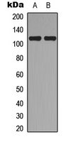 Western blot analysis of Topoisomerase 3 alpha expression in A549 (A); MCF7 (B) whole cell lysates.