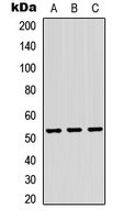 Western blot analysis of TRMT11 expression in HEK293T (A); Raw264.7 (B); PC12 (C) whole cell lysates.