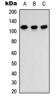 Western blot analysis of TSHZ3 expression in MCF7 (A); Raw264.7 (B); PC12 (C) whole cell lysates.