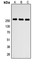 Western blot analysis of ABCA4 expression in HEK293T (A); NS-1 (B); PC12 (C) whole cell lysates.