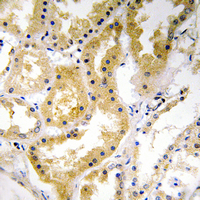 Immunohistochemical analysis of ABHD4 staining in human kidney formalin fixed paraffin embedded tissue section. The section was pre-treated using heat mediated antigen retrieval with sodium citrate buffer (pH 6.0). The section was then incubated with the antibody at room temperature and detected using an HRP conjugad compact polymer system. DAB was used as the chromogen. The section was then counterstained with haematoxylin and mounted with DPX. w