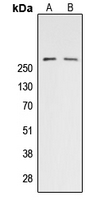 Western blot analysis of ACC alpha (pS80) expression in HeLa (A); NIH3T3 PMA-treated (B) whole cell lysates.