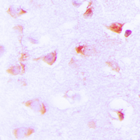 Immunohistochemical analysis of ACC alpha (pS80) staining in human brain formalin fixed paraffin embedded tissue section. The section was pre-treated using heat mediated antigen retrieval with sodium citrate buffer (pH 6.0). The section was then incubated with the antibody at room temperature and detected using an HRP conjugad compact polymer system. DAB was used as the chromogen. The section was then counterstained with haematoxylin and mounted with DPX. w