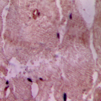 Immunohistochemical analysis of ACOT9 staining in human heart formalin fixed paraffin embedded tissue section. The section was pre-treated using heat mediated antigen retrieval with sodium citrate buffer (pH 6.0). The section was then incubated with the antibody at room temperature and detected using an HRP conjugad compact polymer system. DAB was used as the chromogen. The section was then counterstained with haematoxylin and mounted with DPX. w