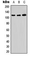 Western blot analysis of ADAMTS10 expression in HeLa (A); PC12 (B); Raw264.7 (C) whole cell lysates.