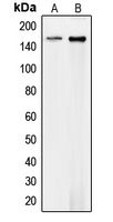 Western blot analysis of Collagen 4 alpha 1 expression in HEK293T (A); mouse endothelial (B) whole cell lysates.