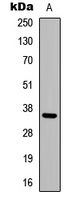Western blot analysis of Adenosine A3 Receptor expression in MCF7 (A) whole cell lysates.